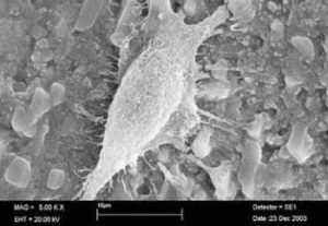 Osteoblasten-Morphologie auf Bioverit-beschichtetem Zirkondioxid